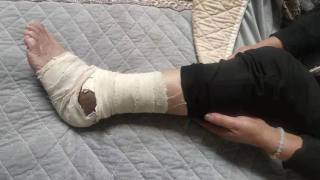 2025新澳正版今晚资料网站和女子遭毒蛇咬伤身亡与女子遭毒蛇咬伤身亡视频
