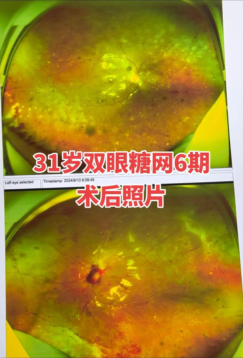 2025全年正版资料大全和被精神病患挖伤双眼与被精神病患挖伤双眼怎么办